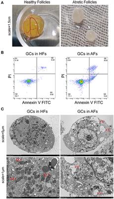 Whole-Transcriptome Analysis of LncRNAs Mediated ceRNA Regulation in Granulosa Cells Isolated From Healthy and Atresia Follicles of Chinese Buffalo